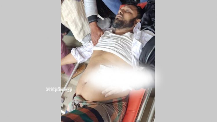 পিস্তল নাড়াচাড়া করতে গিয়ে ব্যবসায়ী গুলিবিদ্ধ