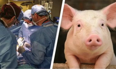 সফলভাবে মানুষের শরীরে শূকরের কিডনি প্রতিস্থাপন