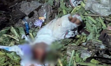  মোহাম্মদপুরে ডাস্টবিনে পড়ে আছে মানুষের খণ্ডিত পা